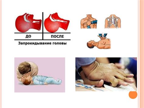 Интерференция со средствами реанимации