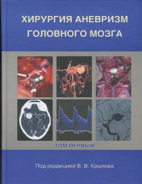 Интраваскулярные методы диагностики аневризм мозга