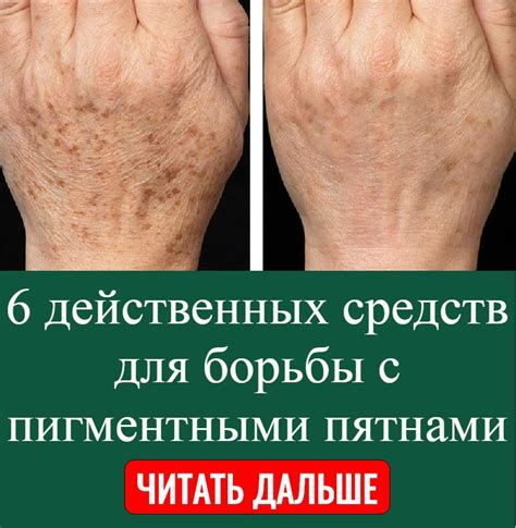 Использование бытовых средств для борьбы с пятнами