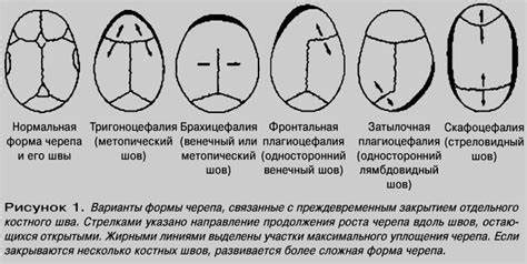 Использование прочных материалов