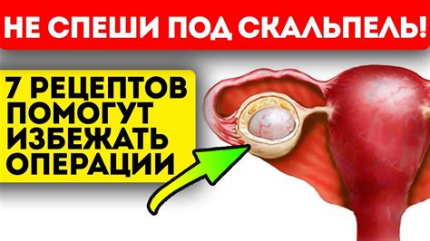 Использование репы в качестве народного средства от эндометриоидной кисты