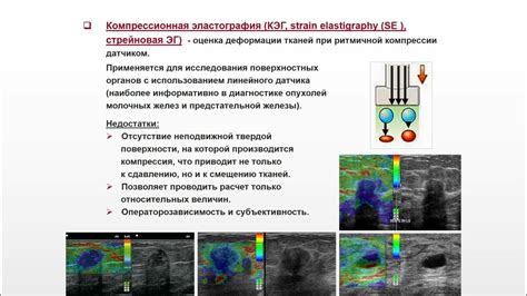 Использование ультразвукового сканирования