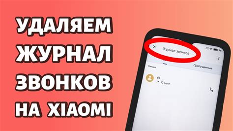 Используйте журнал вызовов