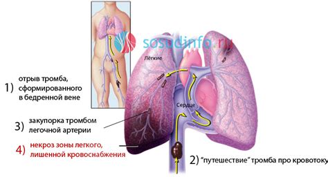 Исход и последствия