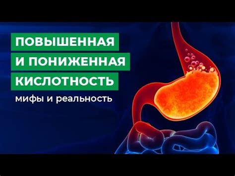 Йогурт и кислотность желудка: факты и мифы