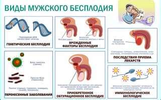 Какие основные причины мужского бесплодия