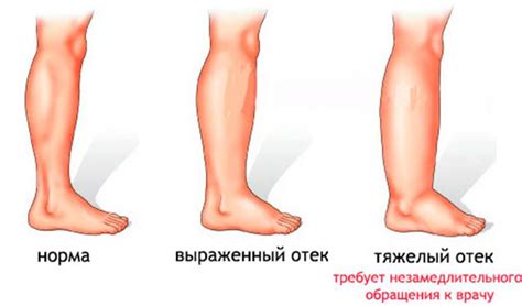 Какие причины могут привести к вращению ног и рук?