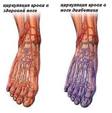 Какие проблемы может сопровождать хруст ноги