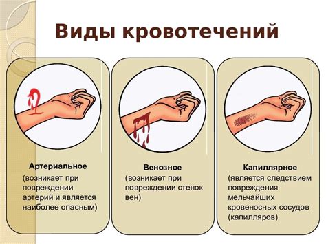 Какие простые способы остановки носового кровотечения можно применить?