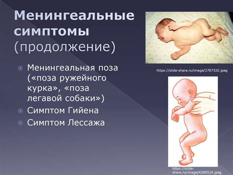 Какие факторы способствуют развитию синдрома у детей