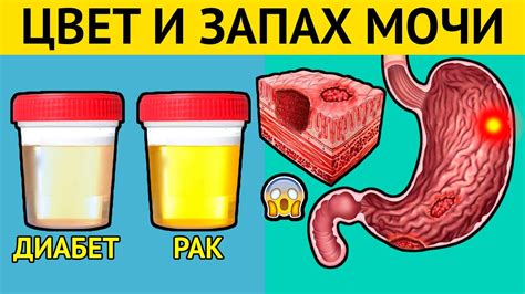 Какие характеристики мочи могут вызывать неприятный запах