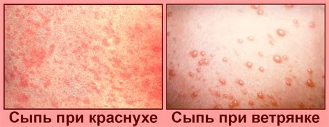 Как бороться с красными пятнами на груди