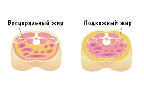 Как бороться с увеличением живота