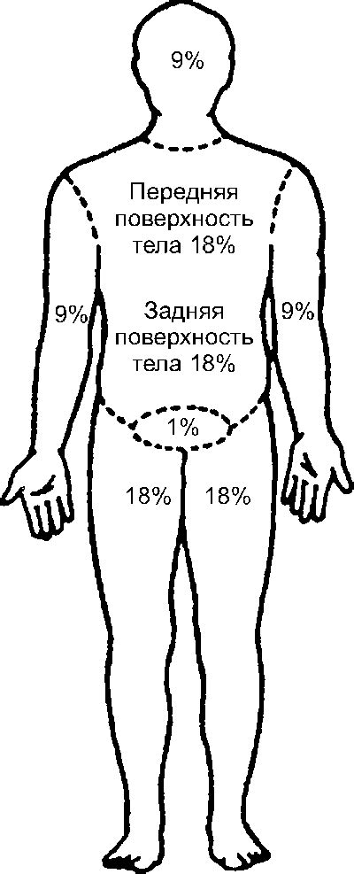 Как быстро и правильно определить площадь ожога