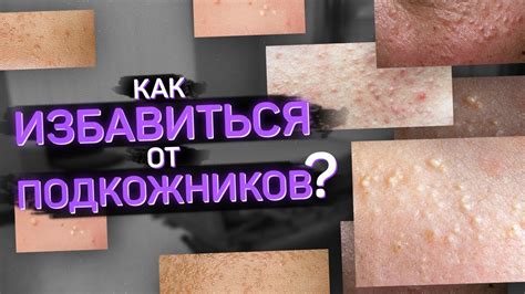 Как выбрать средство, действительно защищающее от появления комедонов?