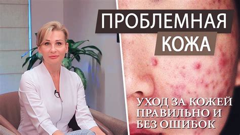 Как избавиться от акне: советы и рекомендации