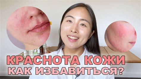 Как избавиться от красноты кожи приложения