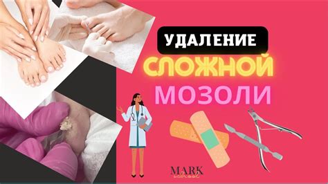 Как избавиться от мозоли на языке: эффективные методы дома