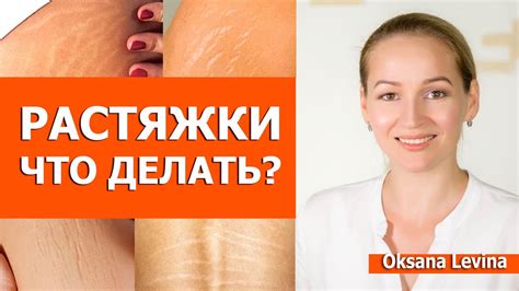 Как избавиться от растяжек на коже: эффективные методы удаления