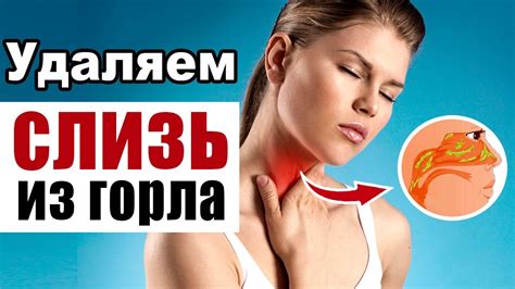 Как избавиться от слизи в горле: эффективные способы