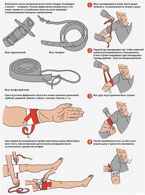 Как накладывать жгут при бытовой травме