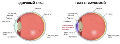 Как определить СД: признаки, диагностика, лечение