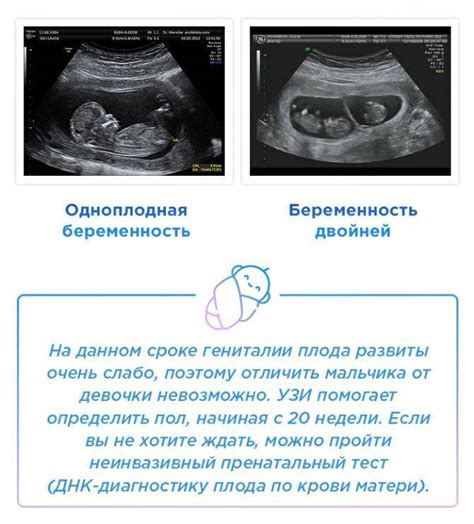 Как определить пол ребенка на УЗИ в 17 недель беременности?