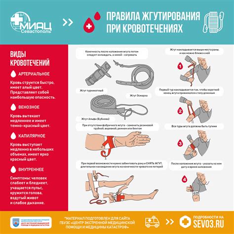 Как остановить кровотечение при бытовой травме