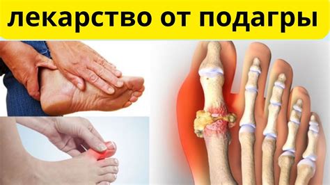 Как очистить суставы от мочевой кислоты: полезные способы и советы