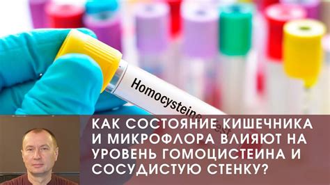 Как повышенный уровень гомоцистеина влияет на организм