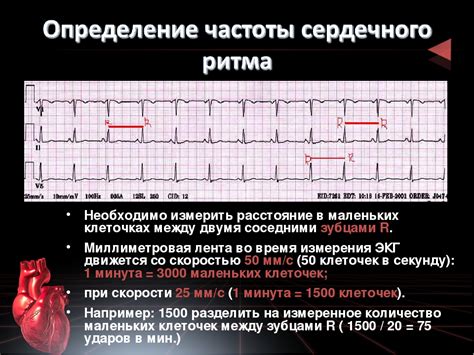 Как правильно пальпировать пульсовую артерию?