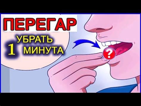 Как предотвратить возникновение запаха перегара