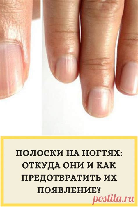 Как предотвратить отслойку геля на ногтях?