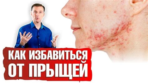 Как предотвратить появление прыщей после чистки