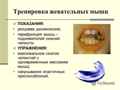 Как предотвратить спонтанное сжатие челюстей