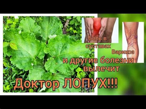 Как приготовить компресс из лопуха?