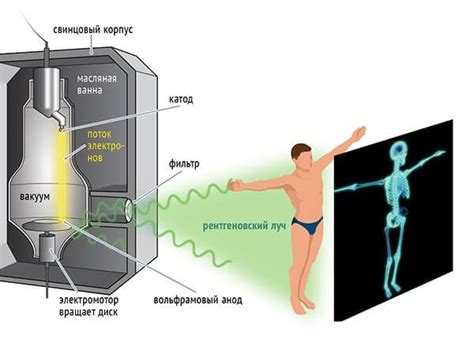 Как работает рентгеновский аппарат