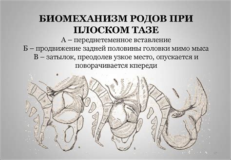 Как распознать узкий таз для родов: ключевые признаки и методы измерения