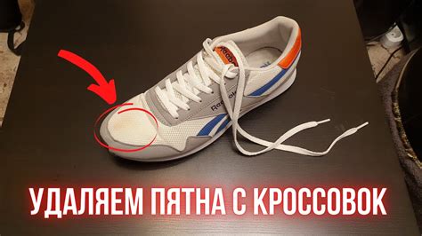 Как снять пятна с белых тканевых кроссовок?