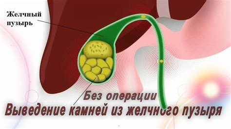 Как удалить песок из шампиньонов