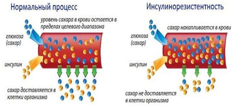 Кефир и его влияние на инсулинорезистентность