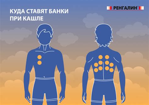 Ключевые моменты для учитывания при запрете банков на спину