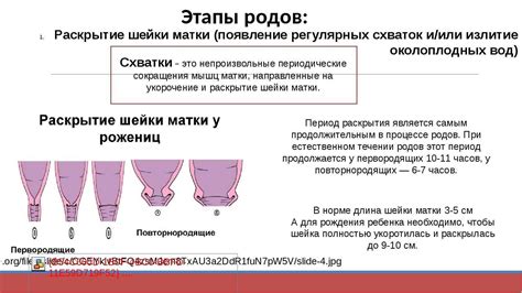 Когда возникают показания для снятия пессария