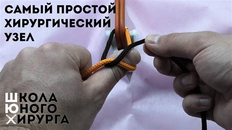 Когда использовать хирургический узел