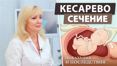 Когда кесарево сечение необходимо