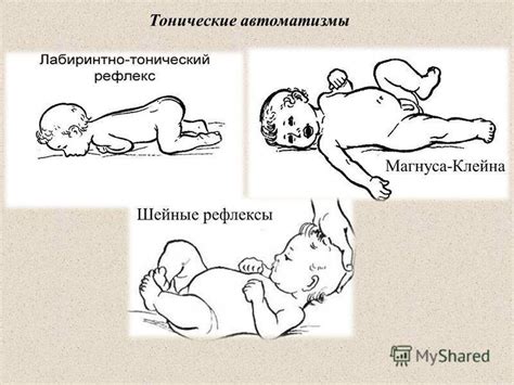 Когда класть ребенка на живот: рекомендации педиатров