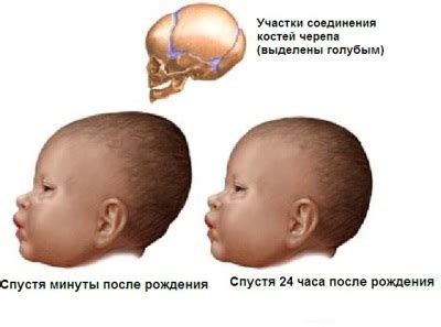 Когда потоотделение головы грудничка становится проблемой?