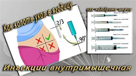 Кому рекомендуют делать прививки в ягодицу?