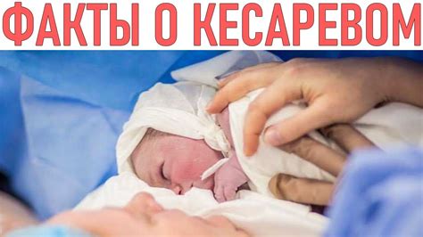 Консультация с врачом перед принятием решения о кесаревом сечении