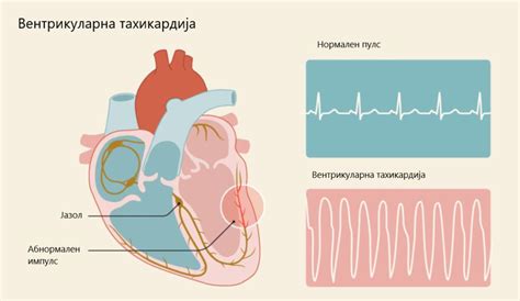 Коньяк и тахикардия